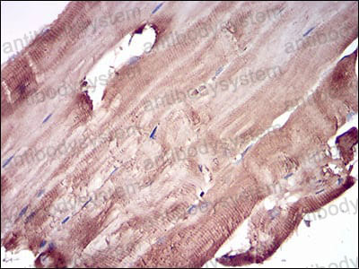 Валидация AntibodySystem RHB92901 (465)