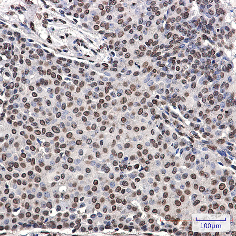 Валидация AntibodySystem RHH06102