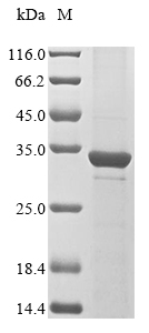 SDS-PAGE