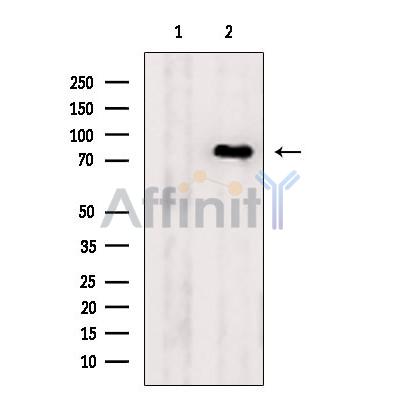 Валидация Affinity AF6186 - 3411