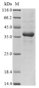 SDS-PAGE