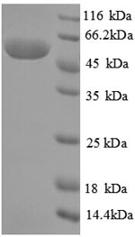 SDS-PAGE