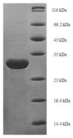 SDS-PAGE