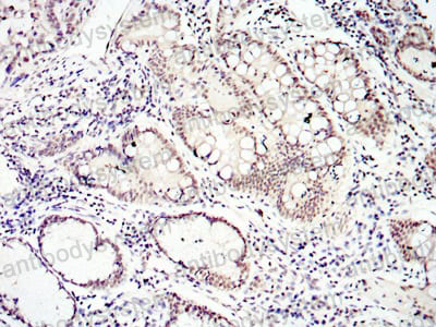 Валидация AntibodySystem RHG55202