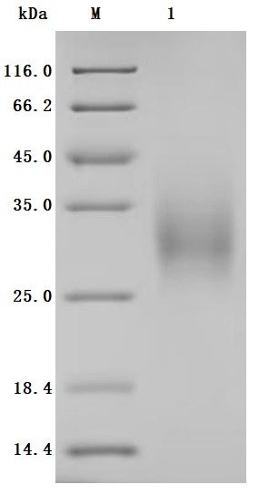 SDS-PAGE