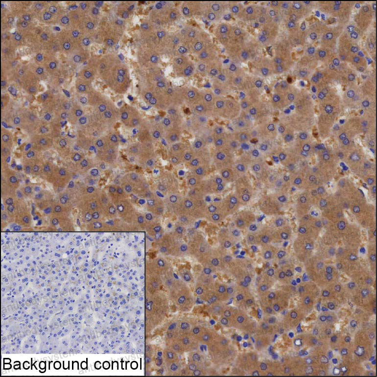 Валидация AntibodySystem RHE75201