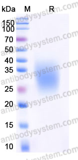 EHJ69201, SDS-PAGE