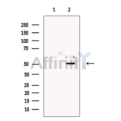 Валидация Affinity DF13484 - 8854