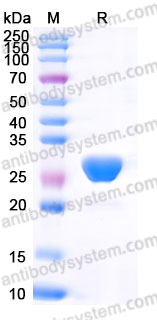AHD58801, SDS-PAGE