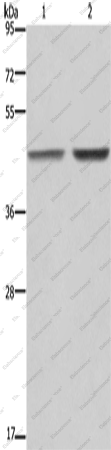 Вестерн-блоттинг, GABPB2, клетки MCF-7 и 231