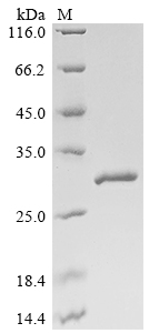 SDS-PAGE