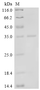 SDS-PAGE
