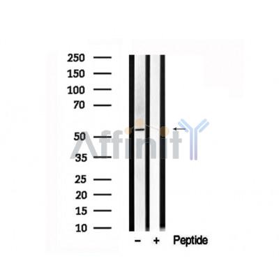 Валидация Affinity AF7545 - 4204