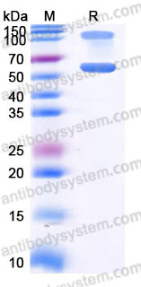 AHD06904, SDS-PAGE
