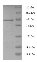 SDS-PAGE