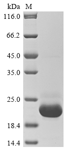 SDS-PAGE