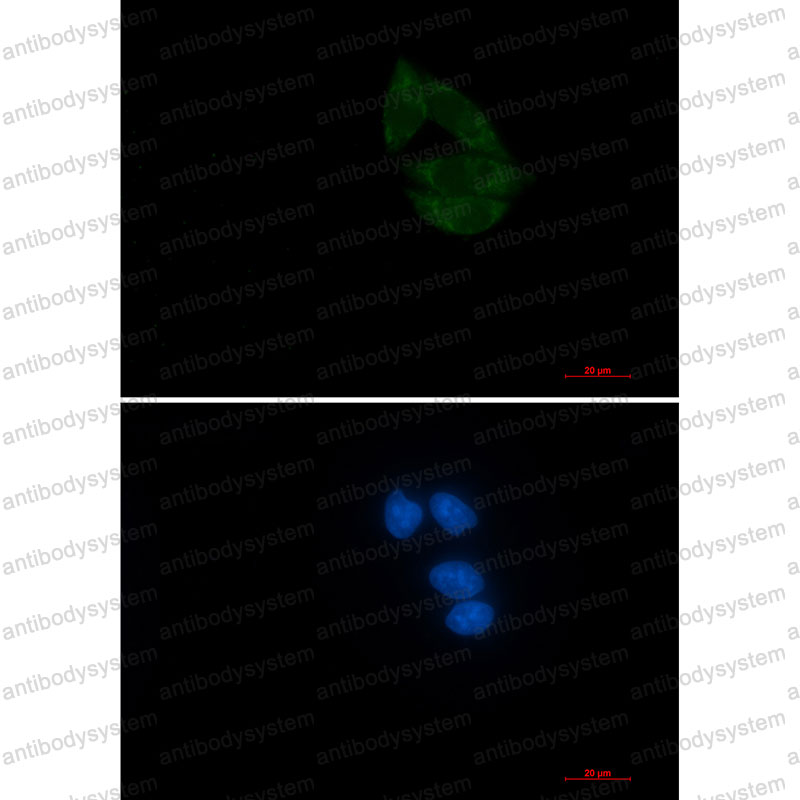 Валидация IF - AntibodySystem RHB29001