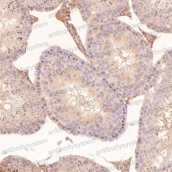 Валидация AntibodySystem RHD75201 (1800)