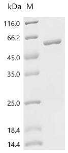 SDS-PAGE