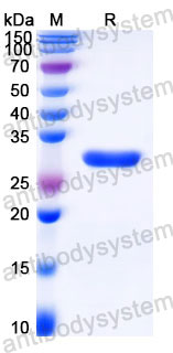 EHC40201, SDS-PAGE
