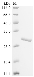 SDS-PAGE