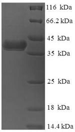 SDS-PAGE