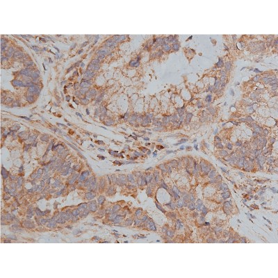 Валидация Affinity AF5101 - 2449