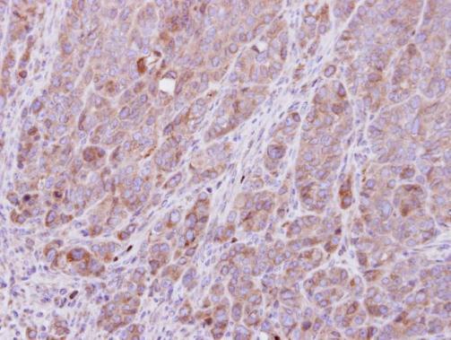 Валидация AssayVector ARM1664(1838)