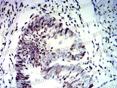 Валидация AntibodySystem RHJ45304