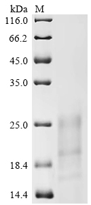 SDS-PAGE