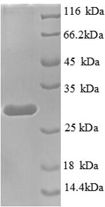 SDS-PAGE