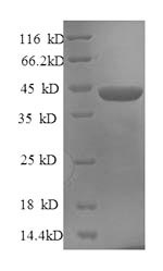SDS-PAGE