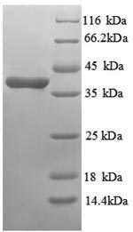 SDS-PAGE