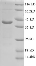 SDS-PAGE