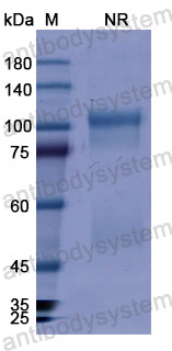 Валидация SDS-PAGE - AntibodySystem DHE03429