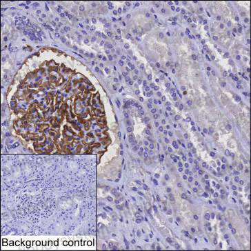Валидация AntibodySystem RHD00604