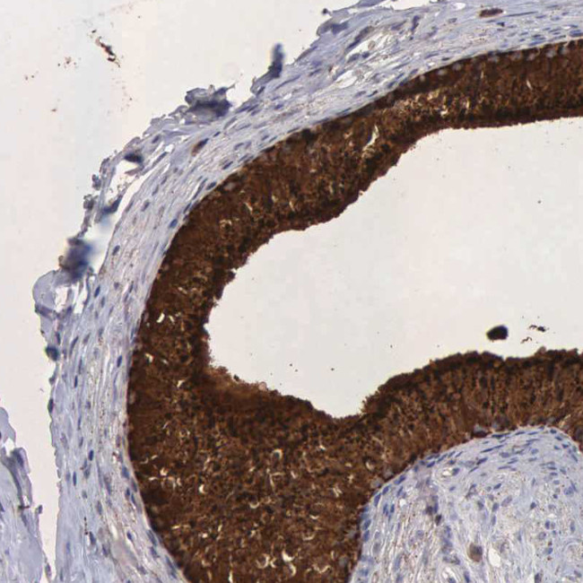 Валидация AssayVector ARM1534(1534)