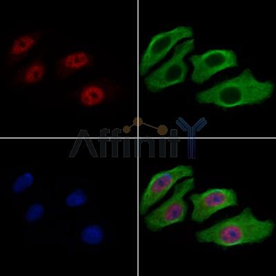 Валидация Affinity AF6035 - 3238