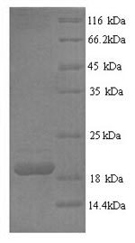 SDS-PAGE