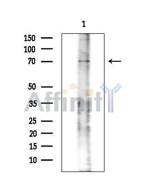 Валидация Affinity DF14187 - 10004
