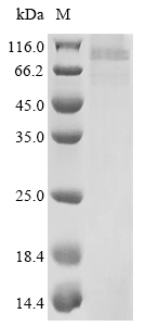 SDS-PAGE
