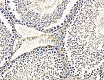 Валидация Affinity DF15357 - 11662