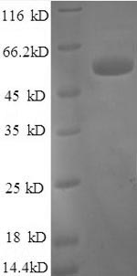 SDS-PAGE