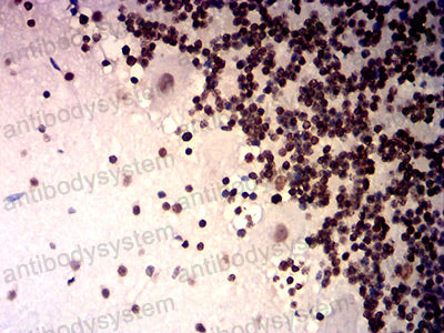 Валидация AntibodySystem RHK13802