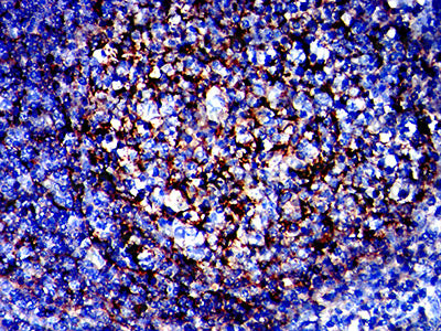 Валидация AntibodySystem RHH81904