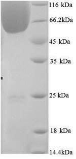 SDS-PAGE