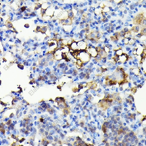 Иммуногистохимия, NADPH oxidase 4, ткань легкого крысы