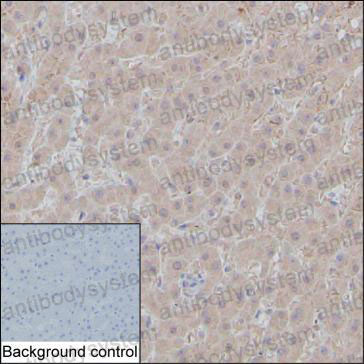 Валидация AntibodySystem RHC01002