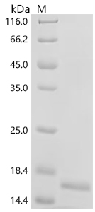 SDS-PAGE