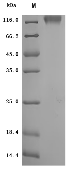 SDS-PAGE